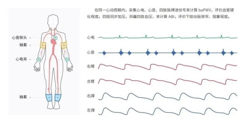 監(jiān)測部位